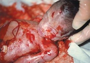 Protesty w Kazimierzu Dolnym